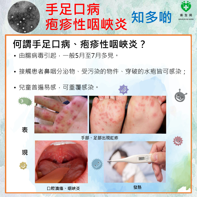 Attachment 手足口病知多啲1.PNG